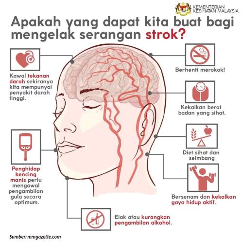 Strok: Apabila Fikiran Terdiam dan Hidup Berubah Kisah Benar dan Pengajaran Kesihatan